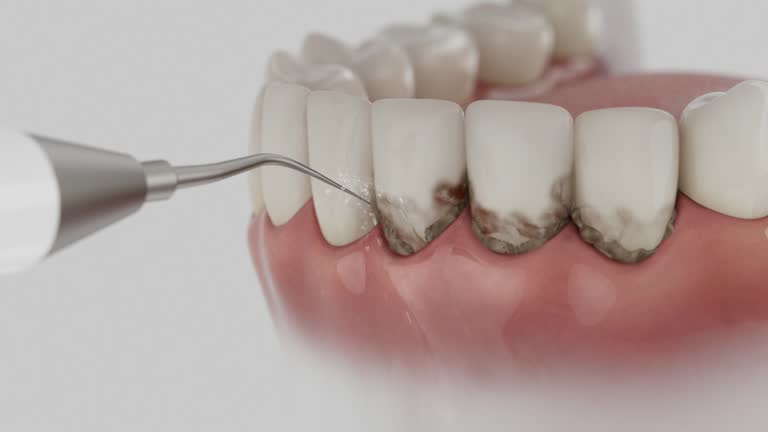 Reliable Dental Implants contractor in Lindstrom, MN by Smile Center Dentistry